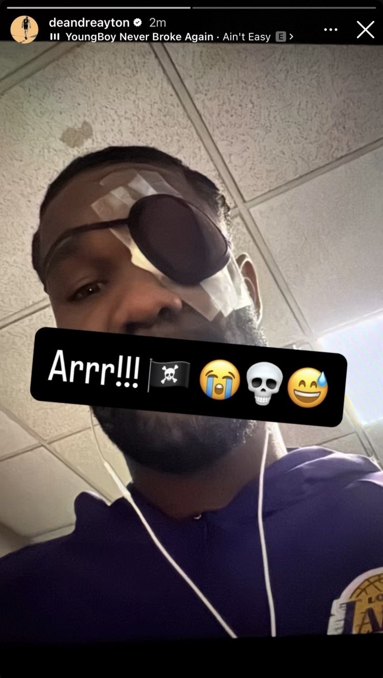 世界杯手机观看-明日洛杉矶德比 艾顿可以出战！里夫斯与蒂耶罗继续缺席